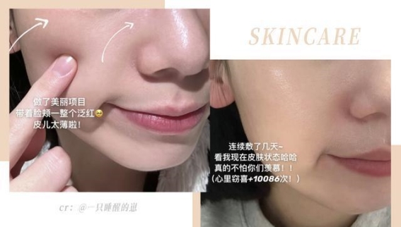 《冬季肌肤保卫战，这些面膜真的能拯救你的皮肤！》