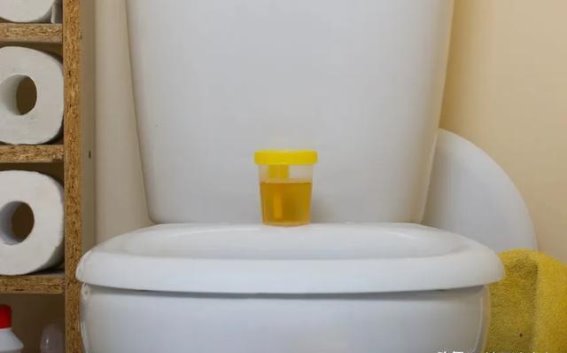 警惕尿液变化，及时应对糖尿病肾病风险