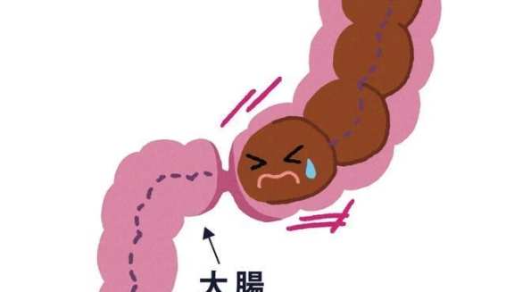 大多数便秘并非上火，而是寒气作祟！中医教你如何散寒通便