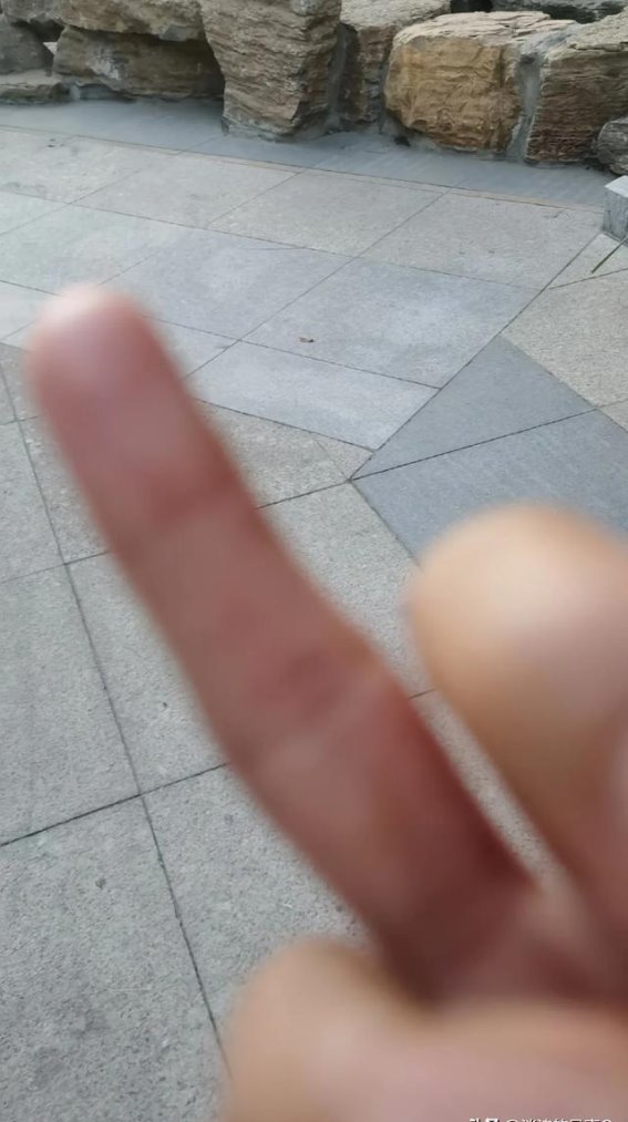 皮肤病诊断的隐秘：经验比仪器更重要