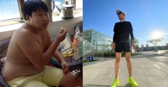 减肥的难题与创新突破：乐城的前沿减重方案