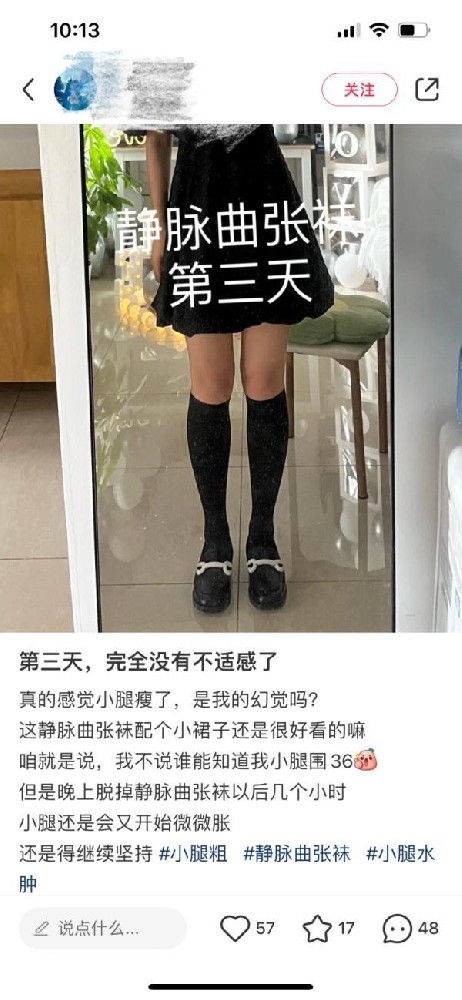 穿静脉曲张袜能“瘦腿”？重庆市药监局：没有燃脂功能